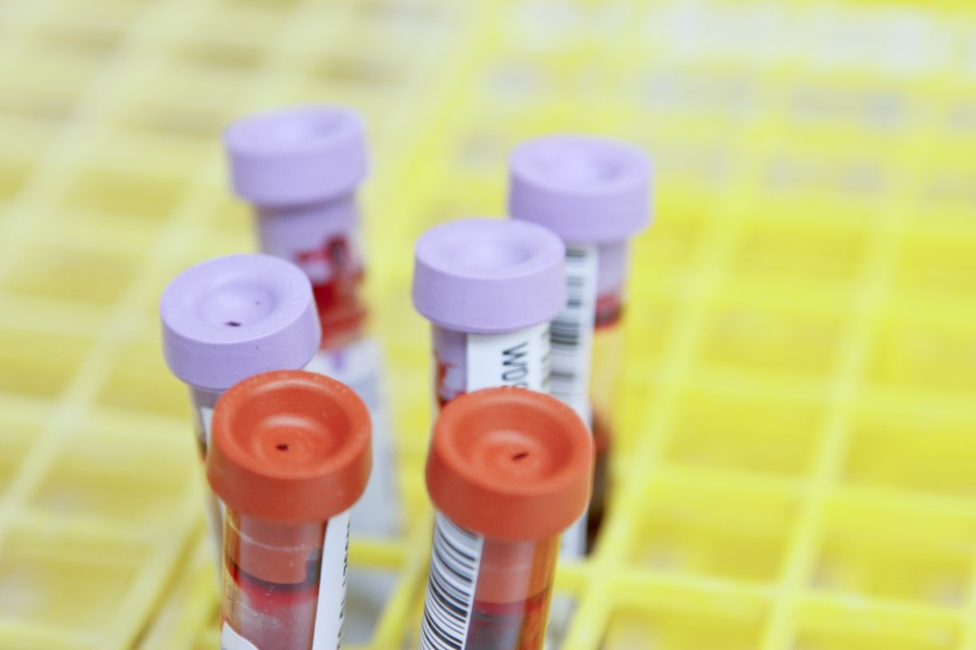 Assessment blood test